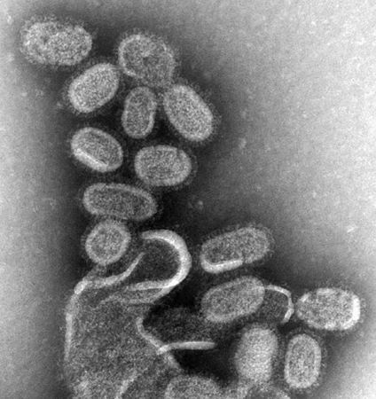 EM_of_influenza_virus (424x450).jpg